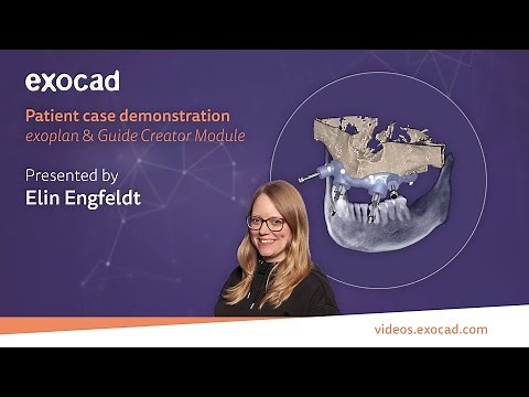 Patient Case Demonstration (1/6): exoplan & Guide Creator Module