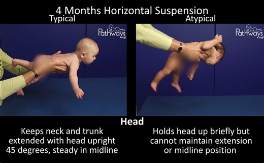 What does your 4 month old baby's motor skills look like in the horizontal suspension position? Use this typical and atypical motor development video to help you recognize early motor delays. Remember to adjust for prematurity. If you have concerns, talk to your healthcare provider. ➡️ View full video: https://pathways.org/watch/4-month-old-typical-and-atypical-motor-development/ | Pathways.org