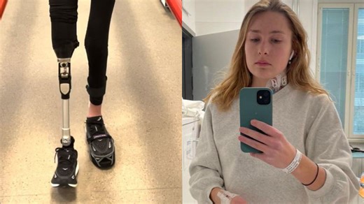 "My bionic leg gave me my life back after two failed amputations"