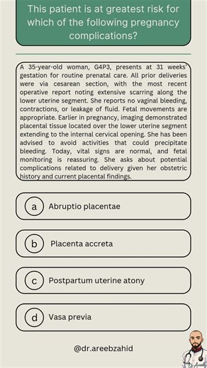 USMLE Step 2ck HY OBGYN: Risk factor association | #usmle #education