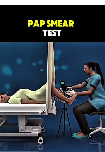 Ever wondered how a Pap smear test is performed? #PapSmear #CervicalCancerScreening #WomensHealth #GynecologicHealth #PreventiveCare