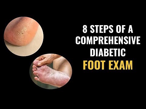 8 Steps of a Comprehensive Diabetic Foot Examination