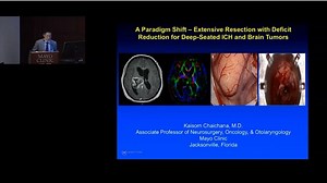 Deep-seated intracranial hemorrhage and brain tumors - Mayo Clinic