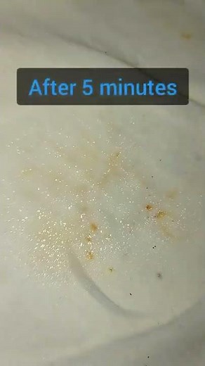 How to Remove Rust Stains from Clothes