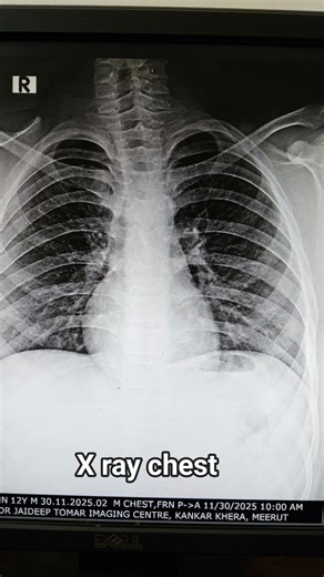 #xray #chest #anatomy #medicalimaging #anatomy #science