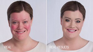 70K views · 1.1K reactions | Imagine never wearing foundation again…...