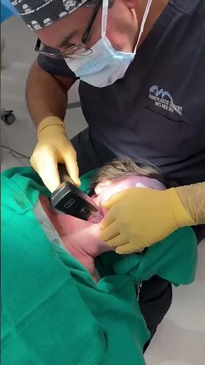 "Facial Rejuvenation with Morpheus 8 Microneedling & ProNox | Dr. Polo Miami Makeover"