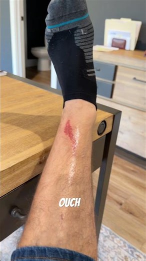 Beginner CrossFit Initiation 😂 | Rope Climb FAIL & Rope Rash Lesson Learned