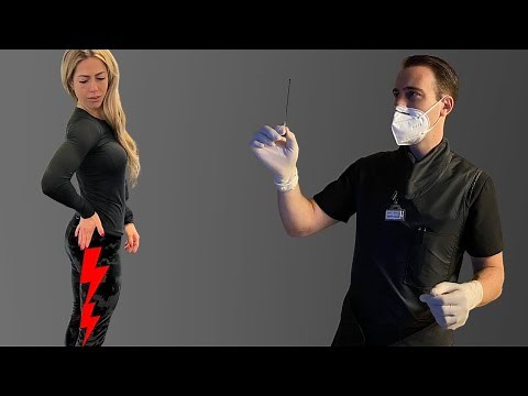 Epidural Steroid Injection (ESI) For Lower Back and Leg Pain | Is It Worth The Poke?