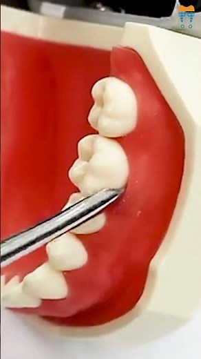 How to Use a Luxator for Painless Extractions! 🦷 Products Link in Comments ✨ #shorts