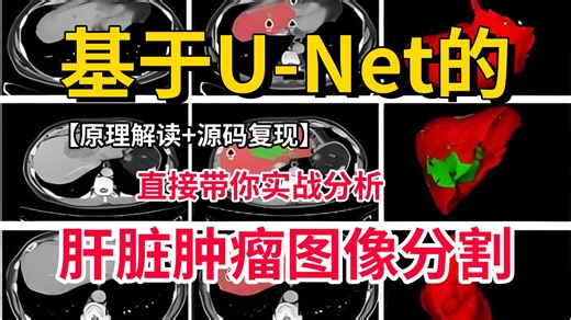 【医学图像分割项目实战】基于U-Net模型的肝脏肿瘤图像分割实战教程，从环境部署到项目实战，究极通俗易懂！（深度学习/计算机视觉）