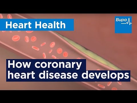 How coronary heart disease (atherosclerosis) develops | Bupa Health
