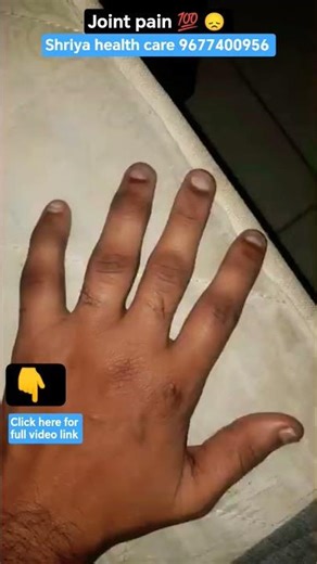 Joint pain 💯 😞 #shorts #viral #trending #health #jointpain #jointpainrelief #arthritis #pain #tamil