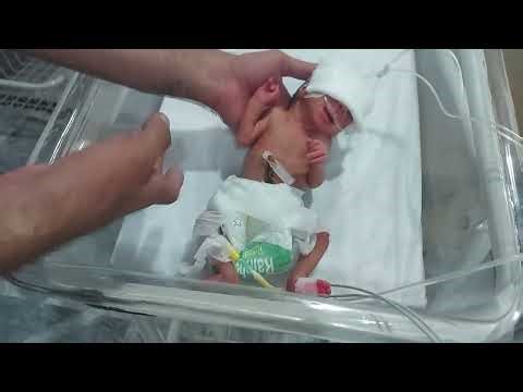 How Premature Babies Are Cared for in Incubator | Step-by-Step NICU Guidelines |