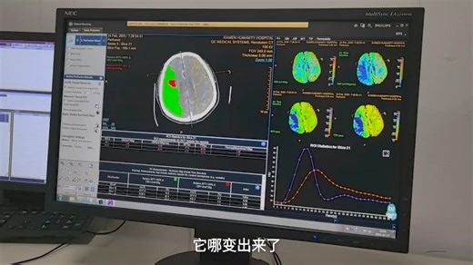 CTP 飞利浦后处理