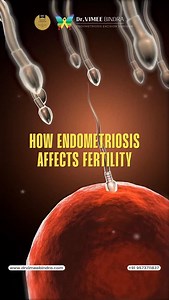 Endometriosis doesn’t “make you less fertile.” It creates a hostile pelvic environment through inflammation, altered anatomy, adhesions, and impaired implantation — all biological mechanisms, not personal shortcomings. Understanding how Endometriosis affects egg quality, tubal function, and the pelvic microenvironment is the first step toward choosing the right treatment and preserving fertility options early. Normalize informed care. Not blame. #EndoFertilityScience #EndometriosisAwareness #Fer