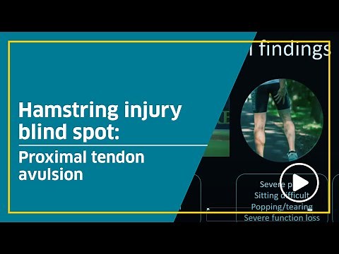Hamstring injury blind spot: Proximal tendon avulsion