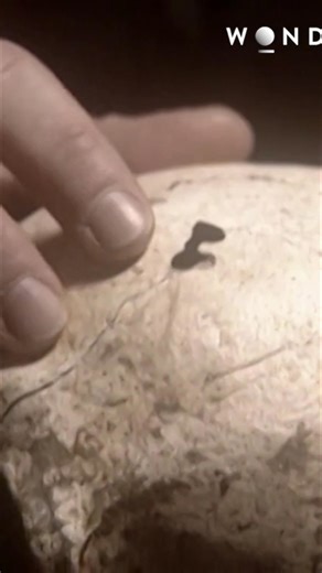 This soldier's skull reveals the brutal reality of war. Musket ball impacts caused crushed bone and rounded depressions. Many soldiers died from head trauma, like this one. The skull shows puncture wounds and fractures extending towards the eye and back of the head. #Archaeology #CivilWar #History #Skull #Trauma #MusketBall | The Wonder Channel