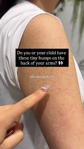 1.9M views · 1.8K reactions | PARASITES & SKIN CONDITIONS: VERY...