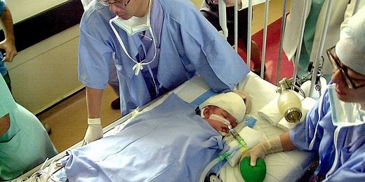 What Was the Longest Surgery Of All Time?