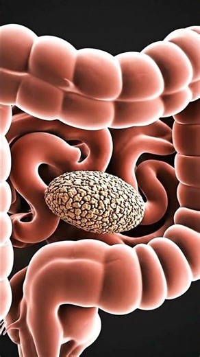 Constipation Explained: How Digestion Slows and Affects Your Body | #Shorts #humanbody #shortsfeed