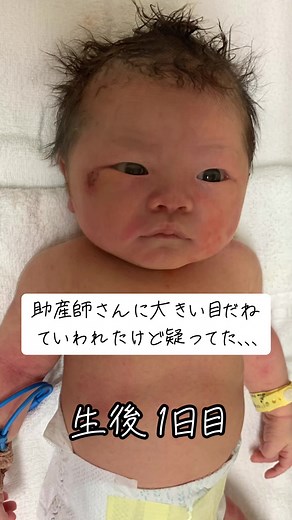 赤ちゃんの目が大きく変化！ガッツ石松からかわいい女の子への成長