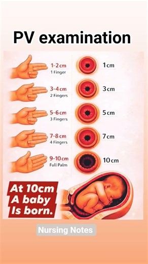 #important #medical pv examination