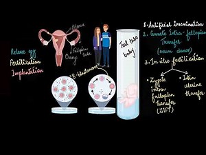 In vitro fertilization and surrogacy | Reproductive health | Biology | Khan Academy