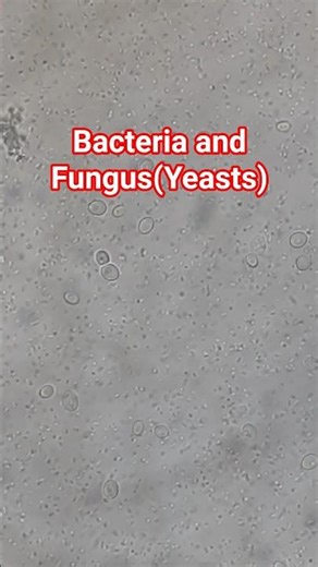 Bacteria and fungus under the microscope #microscope #shorts