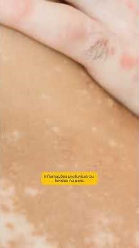 Common Symptoms of Skin Diseases #health #skincare #cbd