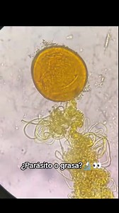 310K views · 2.6K reactions | Microscopy ❤️ #lablife #microbiology #diagnosis | Lab life | Facebook