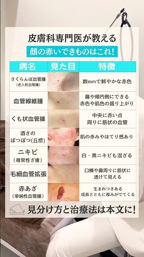 【そのできもの】赤いポツポツができました…【これかも】#ファラド皮膚科 #美容皮膚科 #皮膚科専門医 #美肌ケア #vビーム