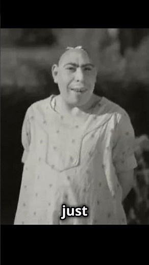 Schlitzie: The Tragic Life of a Circus Legend