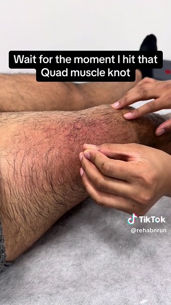 Expert Techniques for Deep Muscle Knot Release