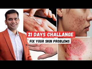 21 Days Challenge | Cure Your All Skin Problems - Dr. Vivek Joshi