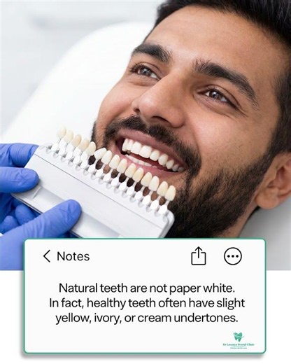 The Truth About White Teeth: A Natural Smile Is More Beautiful | Lavanya Dental Clinic