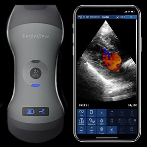 Portable Ultrasound | EagleView Dual-Head Wireless Handheld Ultrasound
