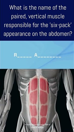 Can you name this muscle?