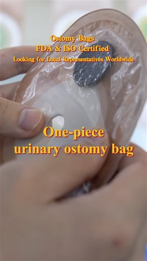 One-piece urinary ostomy bag with a built-in anti-reflux valve.No urine backflow, effectively preventing reflux-induced infections.The ostomy contact surface is soft and skin-friendly.Dual-layer base plate for an ultra-secure fit:the inner layer is made of skin-friendly hydrocolloid material with low allergy risk and strong adhesion;the outer layer is reinforced with spunlace strips to prevent edge curling.Just open the plug-type drain valve to empty urine, then close it tightly.You can even con