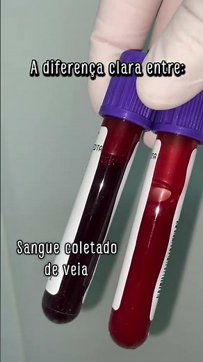 SANGUE VENOSO x ARTERIAL: A Diferença que TODO Biomédico Precisa Saber! 🔴🔵