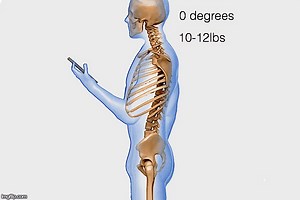 What Texting Does to Your Spine (OMG!)
