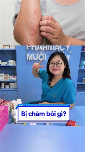 Cách chăm sóc da bị chàm hiệu quả