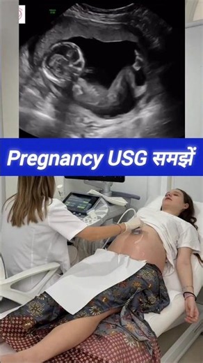 Pregnancy USG