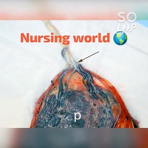 !!NORCET 8.0 IMAGE BASED QUESTIONS!! image based questions in norcet exam #aiims #norcet#study