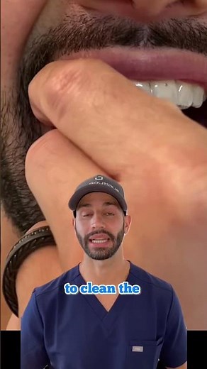 Invisalign cleaning technique that works best for me.