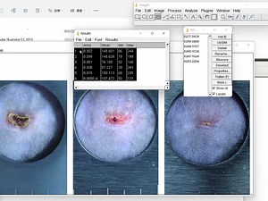 imageJ创面面积统计操作视频