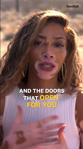 #WinnieHarlow opens up about staying positive no matter the set-back ✨ #BodyIssue #womenshealth