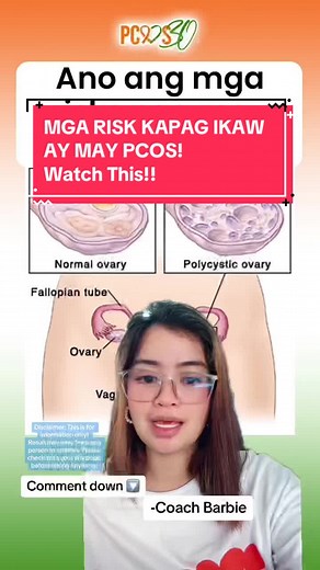 PCOS Risk Factors and Complications Explained