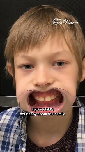 Orthodontist explains reasons for when a child should get braces early on