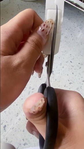 How to Apply a Bandage Properly